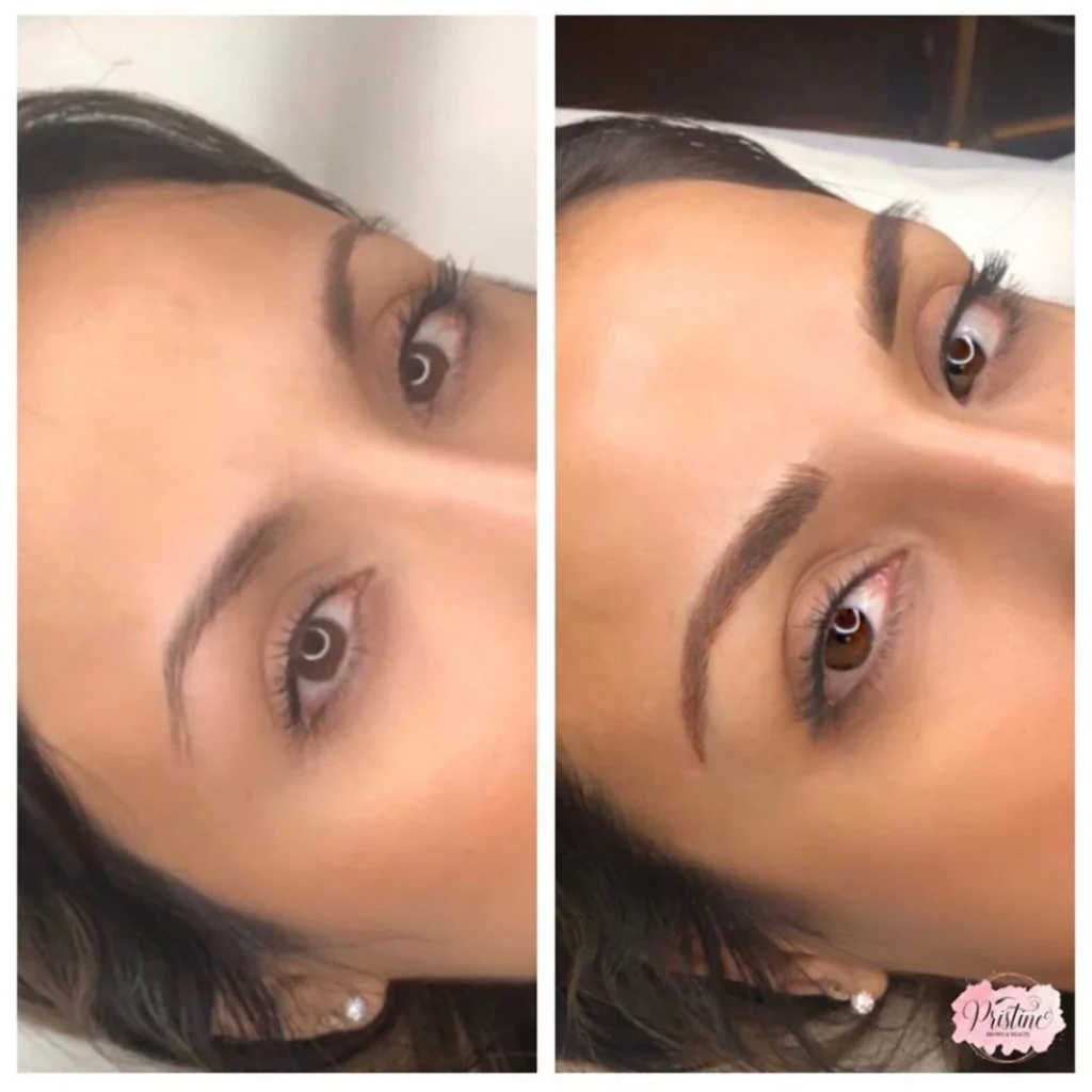 before-after-eyebrow-microblading (2)