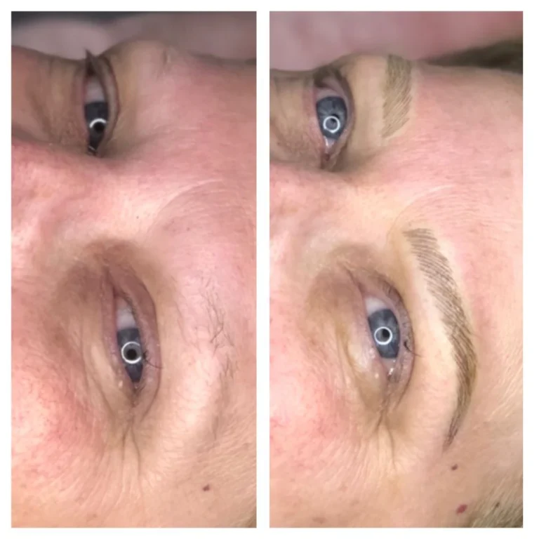 before-after-eyebrow-microblading (4)