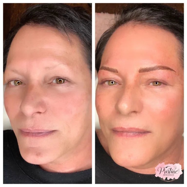 before-after-eyebrow-microblading (7)